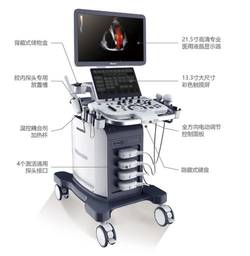 海信还有医疗设备研发团队 旗下首款超声产品发布,9项优势行业领先